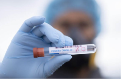 Skoro 7.000 ljudi u Srpskoj umrlo od opakog virusa